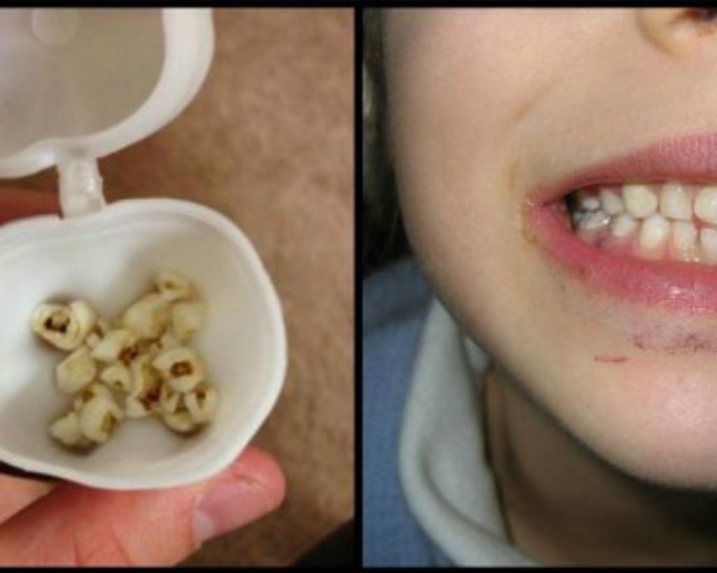 Dientes de